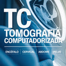 TC | Tomografia Computadorizada em Uberlândia