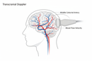 Doppler Transcraniano - Exame Vascular Cerebral