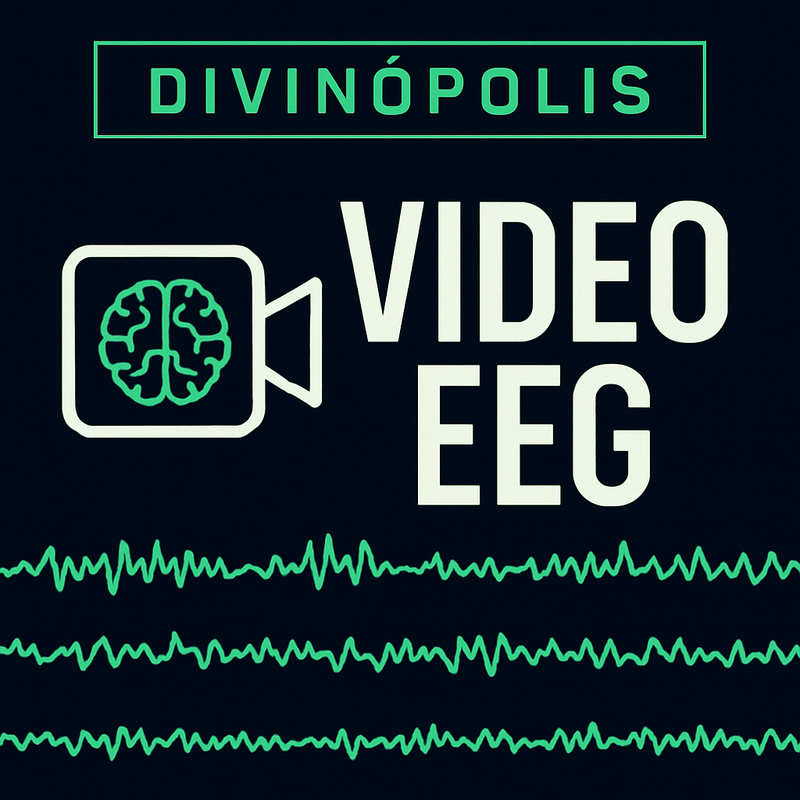 EEG Sono Vigília em Divinópolis